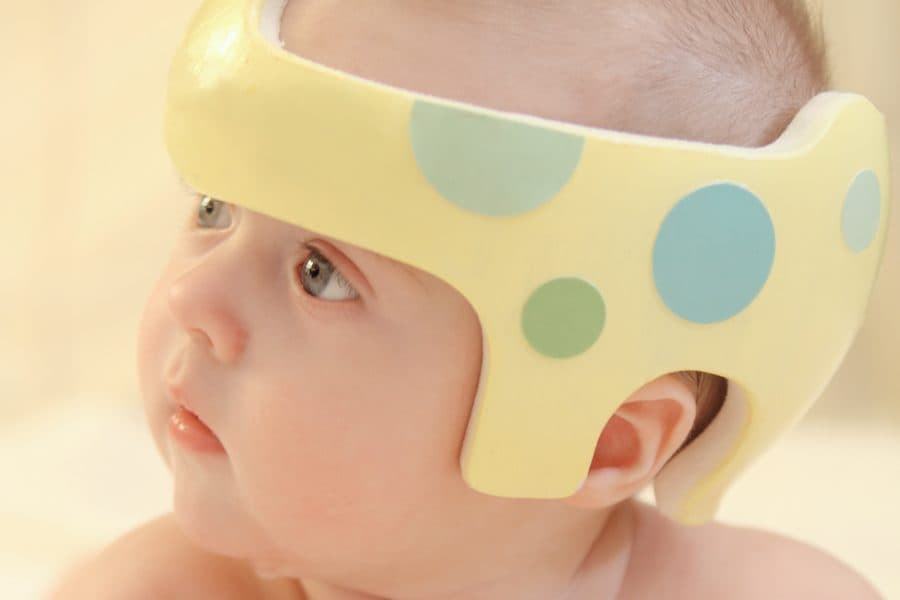 Physical Therapy for Torticollis